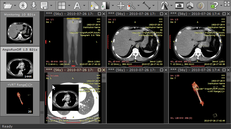 RadiAnt DICOM Viewer 2022.3.1 Crack With License Key Latest